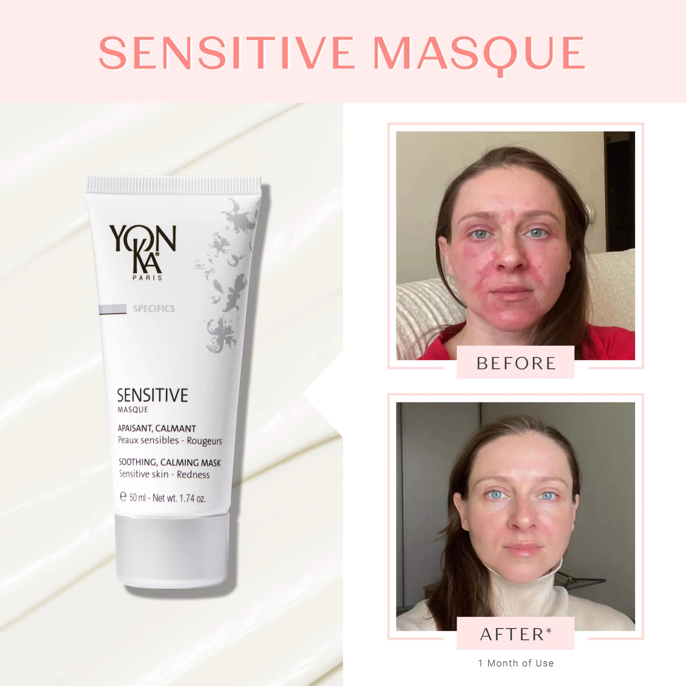 Sensitive Masque - Image 10